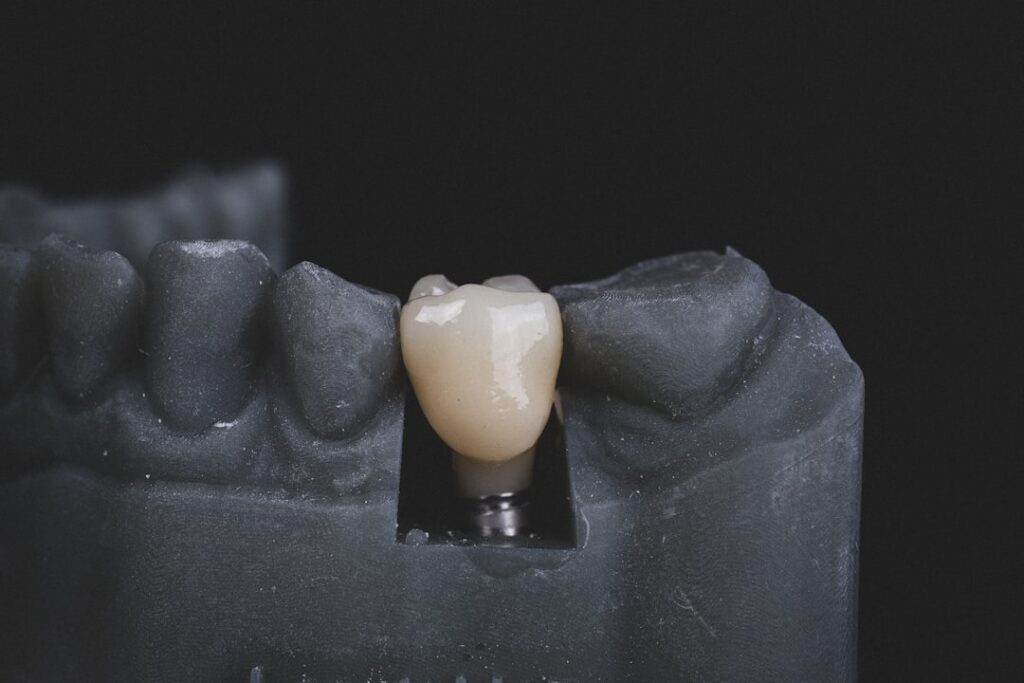 A close-up of a smiling adult having their teeth examined by a dental professional.
